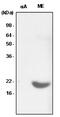 Crystallin Alpha B antibody, MBS200030, MyBioSource, Western Blot image 