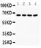 NADPH Oxidase 1 antibody, PA1666, Boster Biological Technology, Western Blot image 