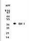 SH3 Domain Containing GRB2 Like, Endophilin B1 antibody, NBP2-24733, Novus Biologicals, Western Blot image 