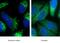 Sequestosome 1 antibody, 18420-1-AP, Proteintech Group, Immunofluorescence image 