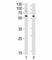 LYN Proto-Oncogene, Src Family Tyrosine Kinase antibody, F52820-0.4ML, NSJ Bioreagents, Western Blot image 