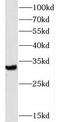 Solute Carrier Family 25 Member 18 antibody, FNab07932, FineTest, Western Blot image 