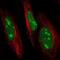 Ubiquitin Conjugating Enzyme E2 R2 antibody, NBP2-57527, Novus Biologicals, Immunocytochemistry image 