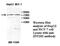 Zinc Finger Protein 202 antibody, MBS416361, MyBioSource, Western Blot image 