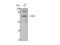 EWS RNA Binding Protein 1 antibody, STJ93010, St John