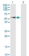 Protein Phosphatase, Mg2+/Mn2+ Dependent 1F antibody, H00009647-M02, Novus Biologicals, Western Blot image 