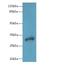 Dehydrogenase/Reductase 12 antibody, LS-C375573, Lifespan Biosciences, Western Blot image 