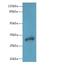 Dehydrogenase/Reductase 12 antibody, LS-C375573, Lifespan Biosciences, Western Blot image 