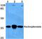 Nucleophosmin 1 antibody, PA5-36279, Invitrogen Antibodies, Western Blot image 