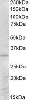 Peroxisomal Biogenesis Factor 26 antibody, PA5-19322, Invitrogen Antibodies, Western Blot image 