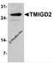 Transmembrane And Immunoglobulin Domain Containing 2 antibody, 7617, ProSci, Western Blot image 