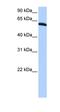 Thyroid Hormone Receptor Interactor 6 antibody, orb330635, Biorbyt, Western Blot image 