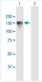 CAP-Gly Domain Containing Linker Protein 2 antibody, H00007461-B01P-50ug, Novus Biologicals, Western Blot image 