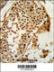 Par-3 Family Cell Polarity Regulator antibody, 63-585, ProSci, Immunohistochemistry paraffin image 