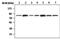 Neurofibromin 2 antibody, MA5-17252, Invitrogen Antibodies, Western Blot image 