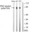 Protein Kinase C Epsilon antibody, TA312226, Origene, Western Blot image 