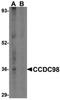 Abraxas 1, BRCA1 A Complex Subunit antibody, PA5-20412, Invitrogen Antibodies, Western Blot image 