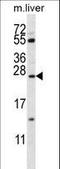 Surfactant Protein C antibody, LS-B10952, Lifespan Biosciences, Western Blot image 