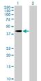 Sorbin And SH3 Domain Containing 3 antibody, H00010174-B01P, Novus Biologicals, Western Blot image 