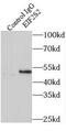 Eukaryotic Translation Initiation Factor 2 Subunit Beta antibody, FNab02700, FineTest, Immunoprecipitation image 