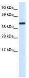 CCR4-NOT Transcription Complex Subunit 2 antibody, TA329883, Origene, Western Blot image 