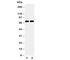 Histidine Decarboxylase antibody, R30792, NSJ Bioreagents, Western Blot image 