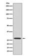 Tyrosine 3-Monooxygenase/Tryptophan 5-Monooxygenase Activation Protein Theta antibody, M03904, Boster Biological Technology, Western Blot image 