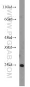 AlkB Homolog 7 antibody, 15470-1-AP, Proteintech Group, Western Blot image 