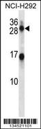 Kallikrein Related Peptidase 14 antibody, 58-017, ProSci, Western Blot image 