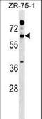 Reticulon 2 antibody, LS-C158905, Lifespan Biosciences, Western Blot image 