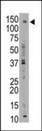 ATP Binding Cassette Subfamily B Member 11 antibody, PA5-13105, Invitrogen Antibodies, Western Blot image 