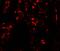 SUZ12 Polycomb Repressive Complex 2 Subunit antibody, A00583, Boster Biological Technology, Immunofluorescence image 