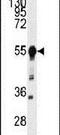 Beta-Secretase 1 antibody, PA5-14879, Invitrogen Antibodies, Western Blot image 