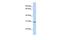 Ring Finger Protein 148 antibody, GTX46878, GeneTex, Western Blot image 