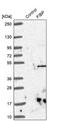 FGF1 Intracellular Binding Protein antibody, PA5-52846, Invitrogen Antibodies, Western Blot image 