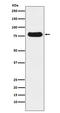 THO Complex 1 antibody, M04626, Boster Biological Technology, Western Blot image 