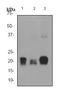 Ferritin Heavy Chain 1 antibody, ab75973, Abcam, Western Blot image 