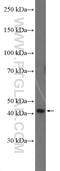 Divergent Protein Kinase Domain 2A antibody, 27145-1-AP, Proteintech Group, Western Blot image 