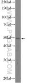 Aldehyde Dehydrogenase 3 Family Member B1 antibody, 19446-1-AP, Proteintech Group, Western Blot image 