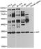 SET Nuclear Proto-Oncogene antibody, LS-C747603, Lifespan Biosciences, Western Blot image 