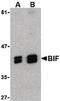 SH3 Domain Containing GRB2 Like, Endophilin B1 antibody, PA5-20248, Invitrogen Antibodies, Western Blot image 