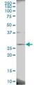 Platelet Activating Factor Acetylhydrolase 1b Catalytic Subunit 3 antibody, H00005050-B01P, Novus Biologicals, Western Blot image 