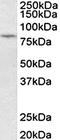 Protein Kinase C Beta antibody, orb107663, Biorbyt, Western Blot image 