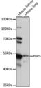 Proline Rich 5 antibody, LS-C750144, Lifespan Biosciences, Western Blot image 