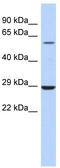 Lysophosphatidylcholine Acyltransferase 1 antibody, TA338682, Origene, Western Blot image 