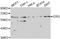 Transcriptional regulator ERG antibody, STJ23567, St John