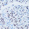 p53 antibody, LS-C746919, Lifespan Biosciences, Immunohistochemistry paraffin image 