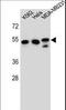 Tubulin Beta 6 Class V antibody, LS-C160335, Lifespan Biosciences, Western Blot image 