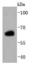 Estrogen Receptor 2 antibody, NBP2-67894, Novus Biologicals, Western Blot image 