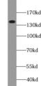 Poly(ADP-Ribose) Polymerase Family Member 10 antibody, FNab06153, FineTest, Western Blot image 